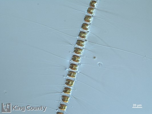 Photo of Chaetoceros diadema